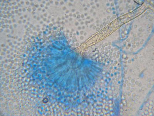 Sachverständigenbüro für Wasserschäden, Bautrocknung und Schimmelpilzsanierung