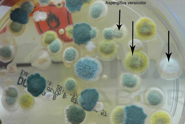 Sachverständigenbüro für Schimmelpilz und Raumausstattung Peter Berner